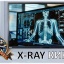 X-RAY КИНО